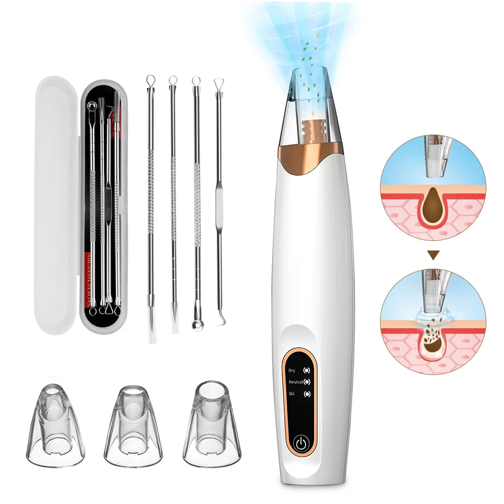 Removedor de Cravos Elétrico 3 Modos - Aspirador Facial para Limpeza Profunda de Poros
