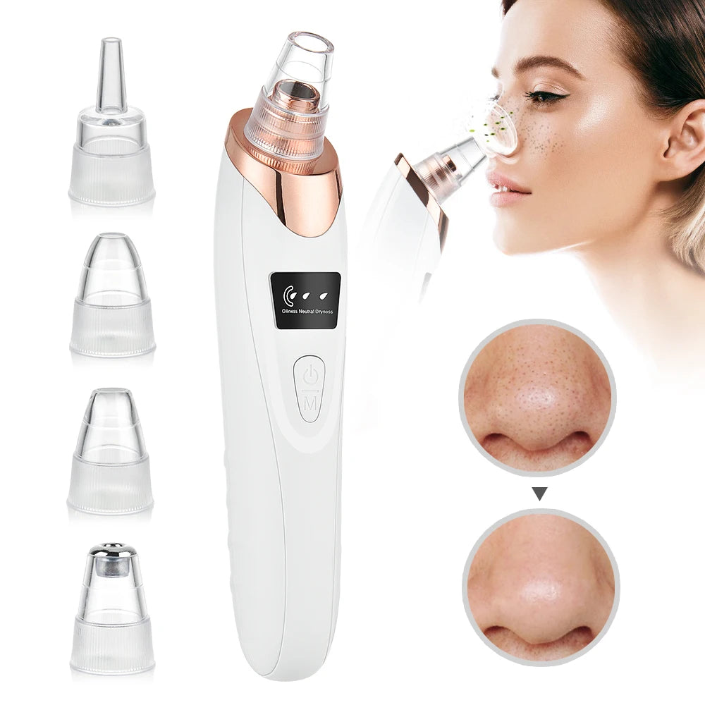 Removedor de Cravos Elétrico 3 Modos - Aspirador Facial para Limpeza Profunda de Poros