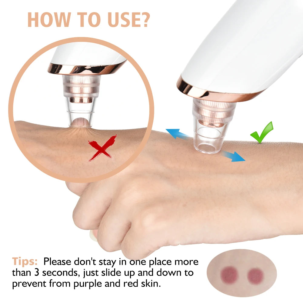 Removedor de Cravos Elétrico 3 Modos - Aspirador Facial para Limpeza Profunda de Poros